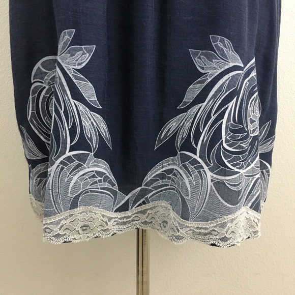 Solemio | Blue & Lacey Dress - Picture 3 of 9